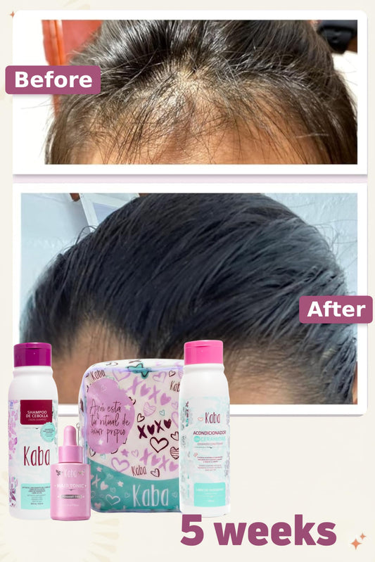 Kaba Beauty onion shampoo and intensive hair growth tonic with white pvc cosmetic bag