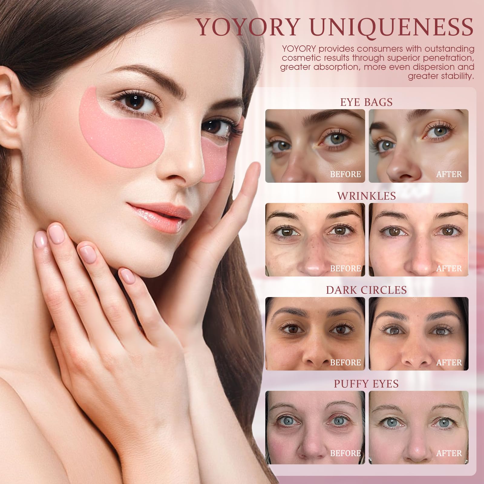 Applying cooling hyaluronic acid under eye patches for dark circles