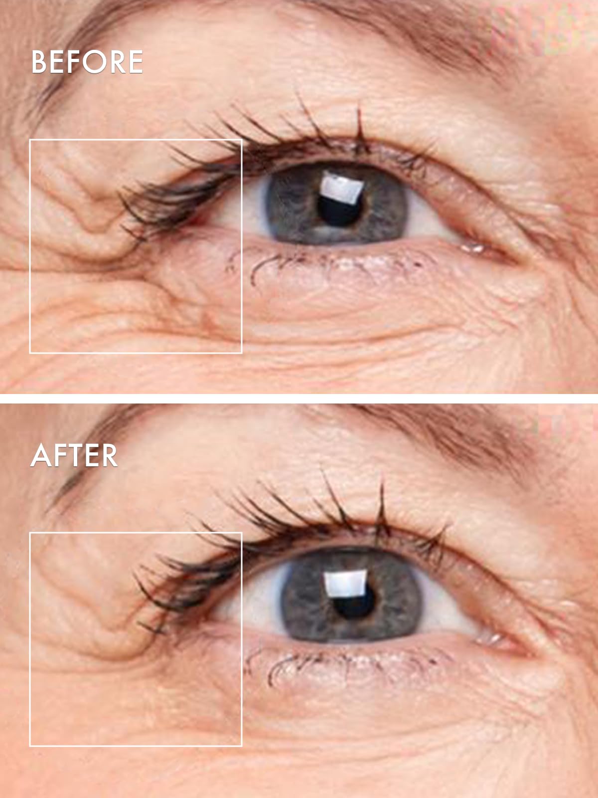 Depology hydrating eye patches packaging details displaying key ingredients like Argireline and hyaluronic acid