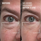Dr. Brandt No More Baggage 0.23 Ounce size packaging overview