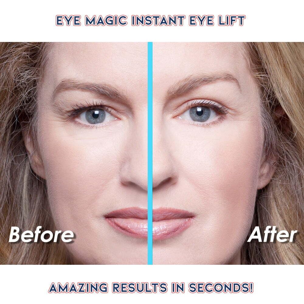 Eye Magic non-surgical eyelid lift strips lifestyle shot