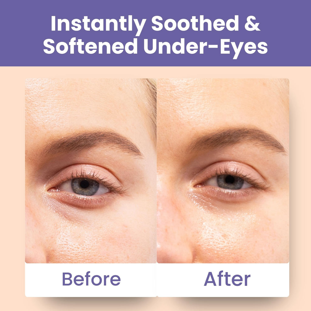Patchology soothing under eye patches lifestyle product shot
