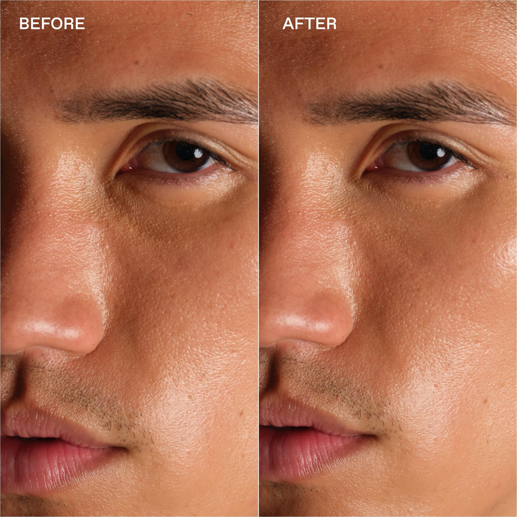 Enhanse Enhanced Eyes eye treatment packaging and box