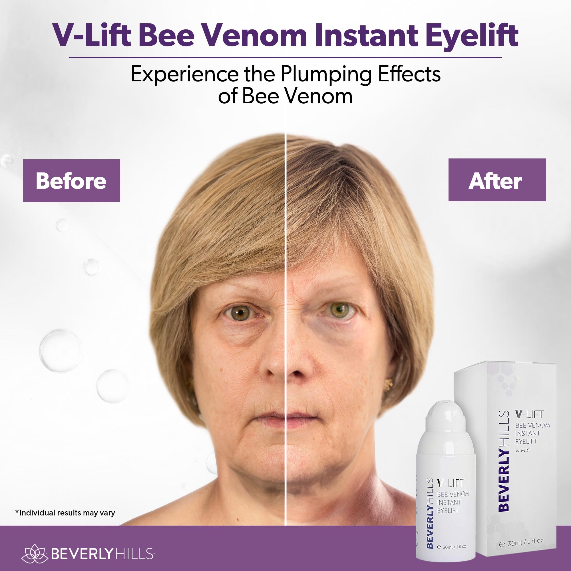Beverly Hills V-Lift Bee Venom serum packaging
