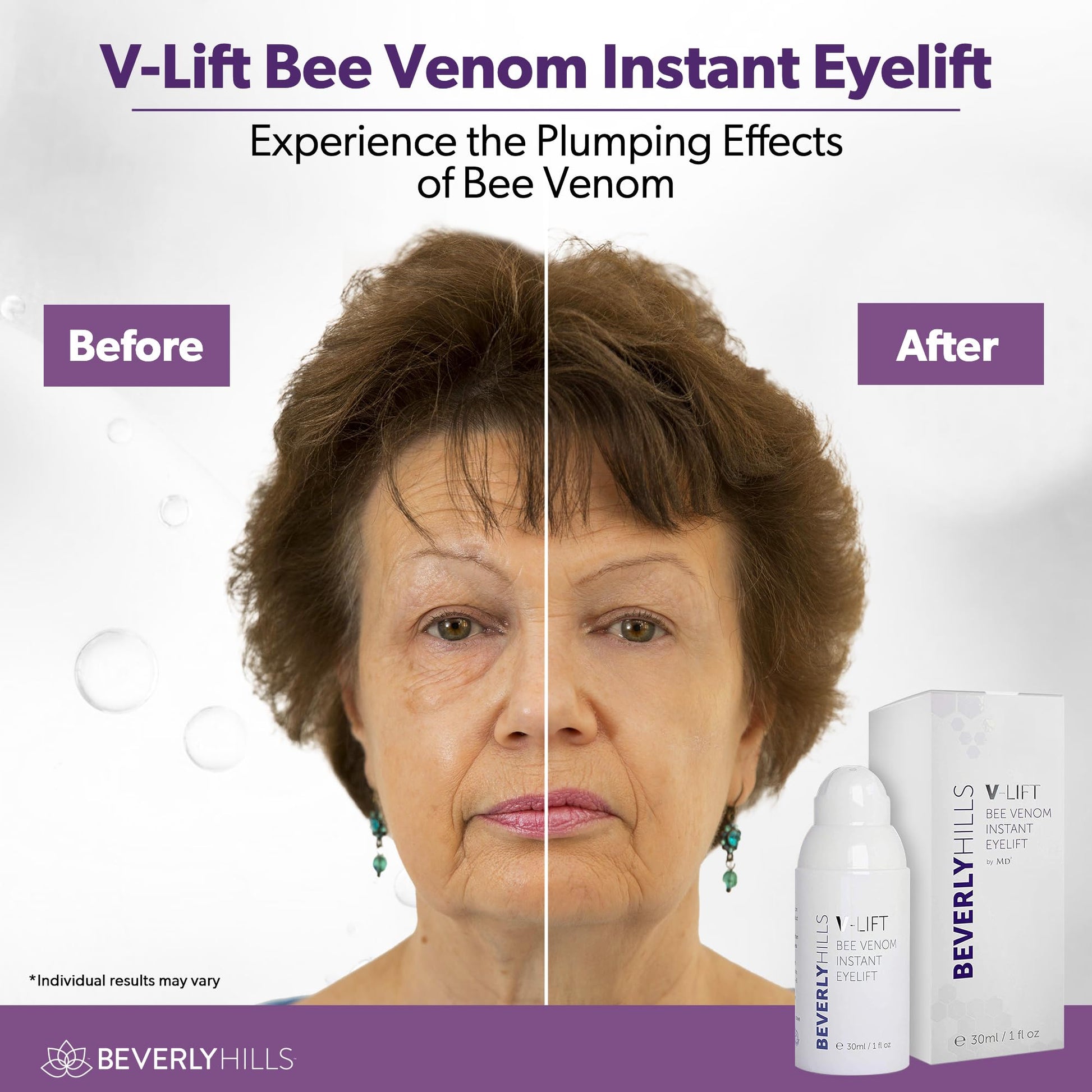 Beverly Hills V-Lift serum for puffy eyes and dark circles
