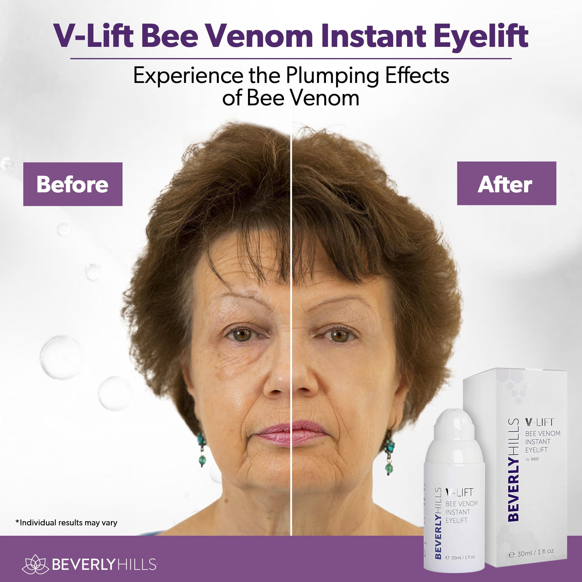 Beverly Hills V-Lift serum for puffy eyes and dark circles