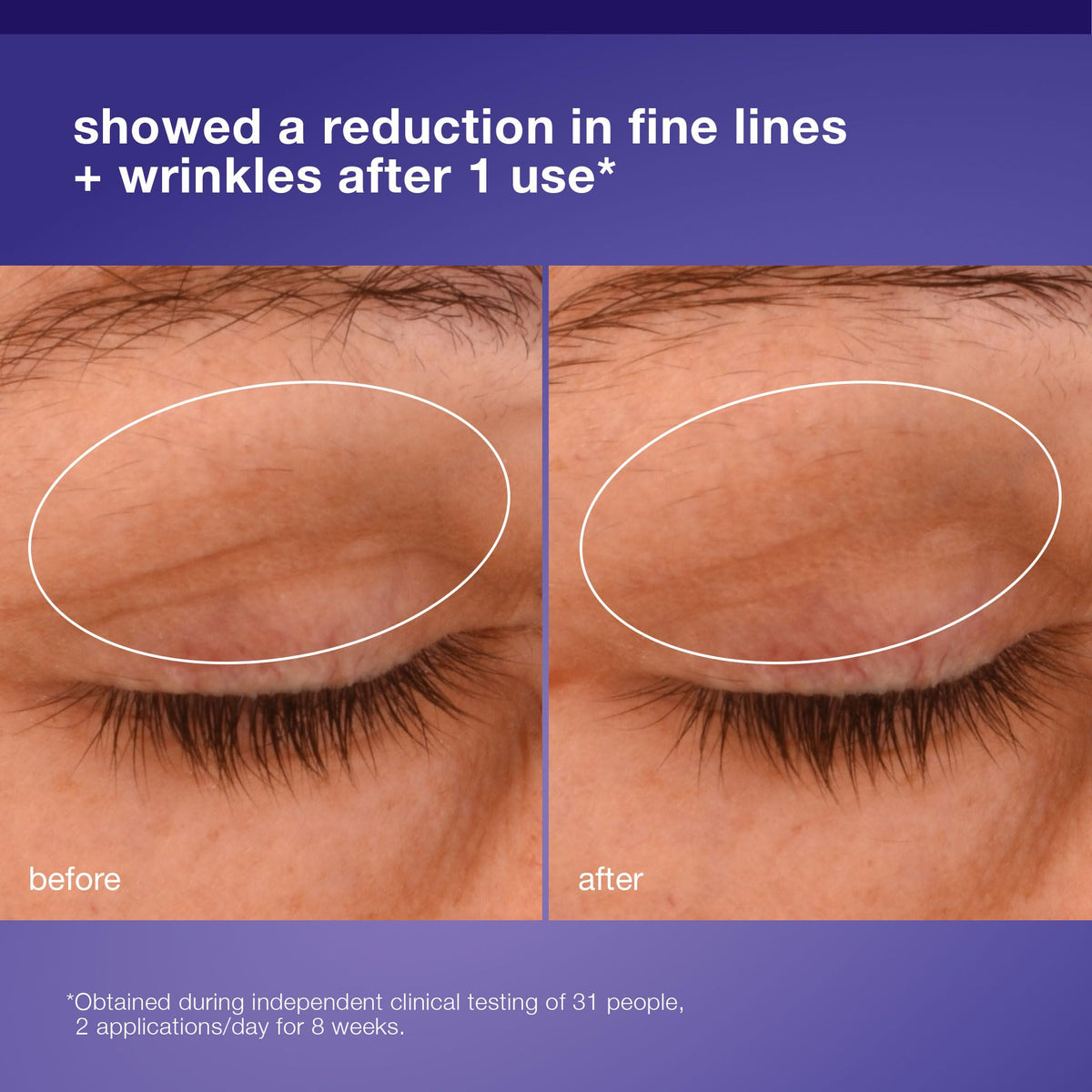 Anti aging eye cream with peptides for mature skin