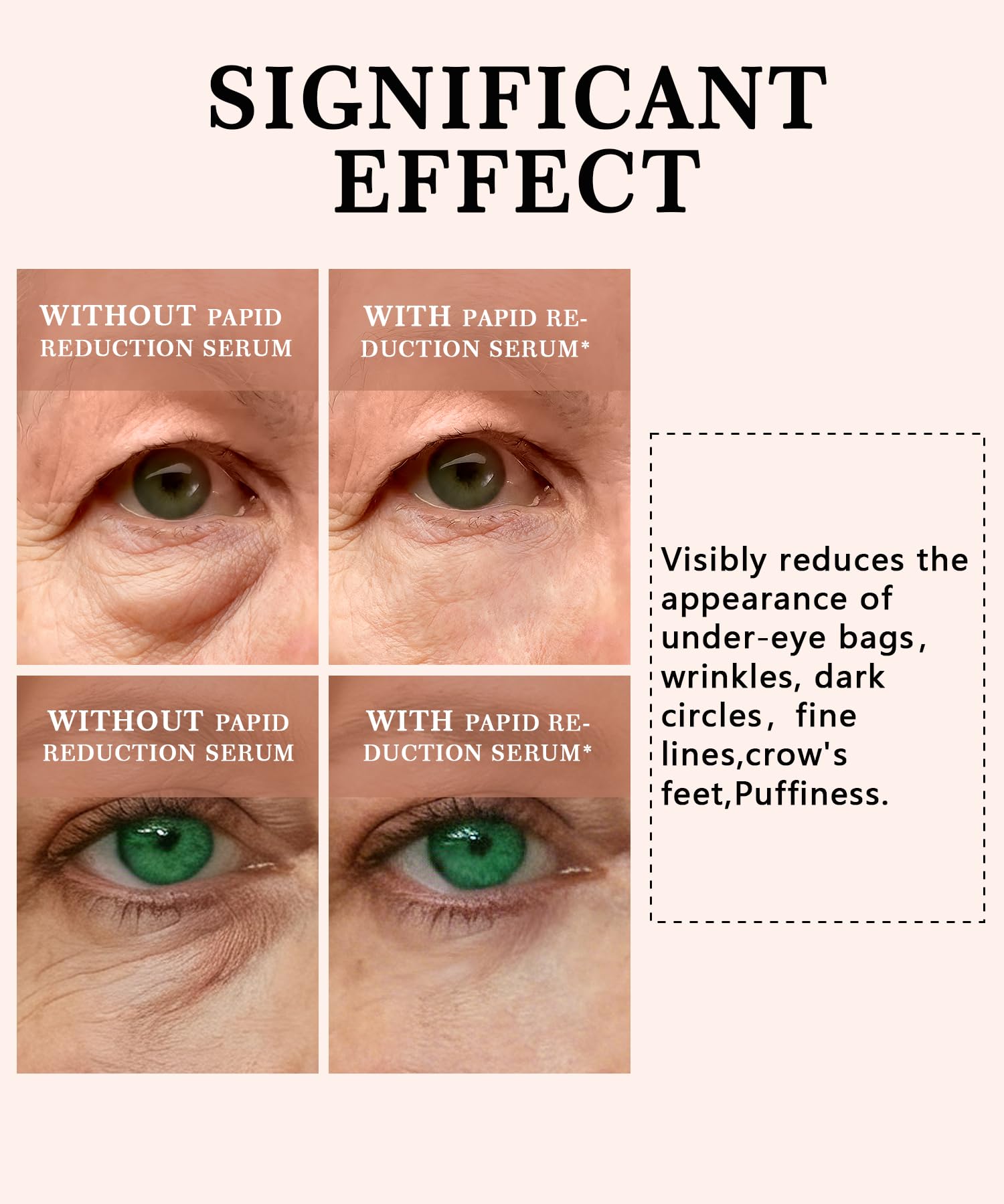 Anti-aging repair serum cream being applied to target eye bags and fine lines.