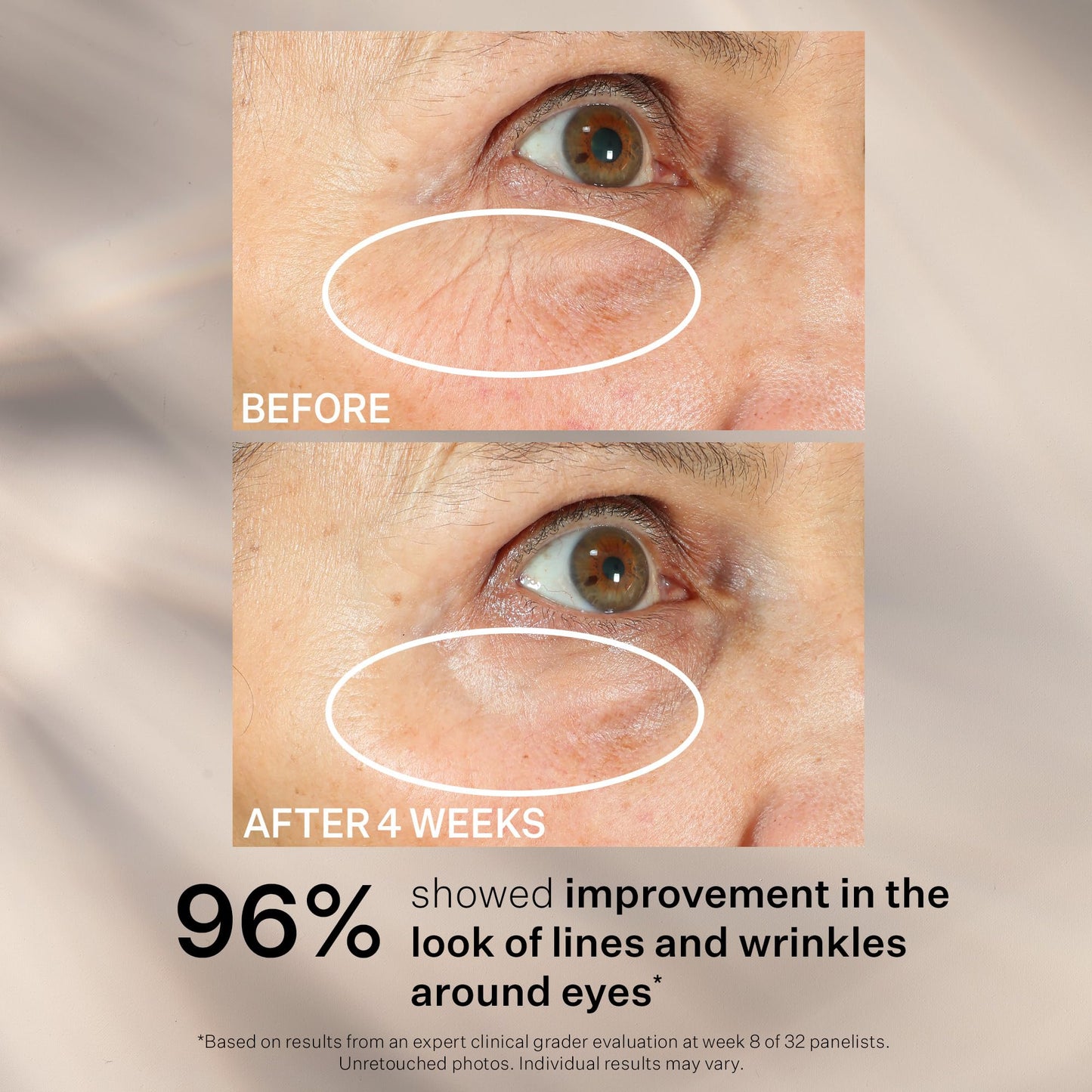 StriVectin anti-aging eye serum for sagging skin