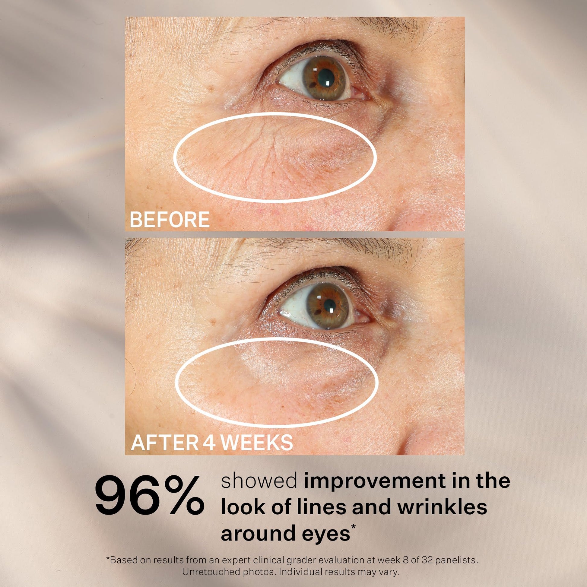 StriVectin anti-aging eye serum for sagging skin