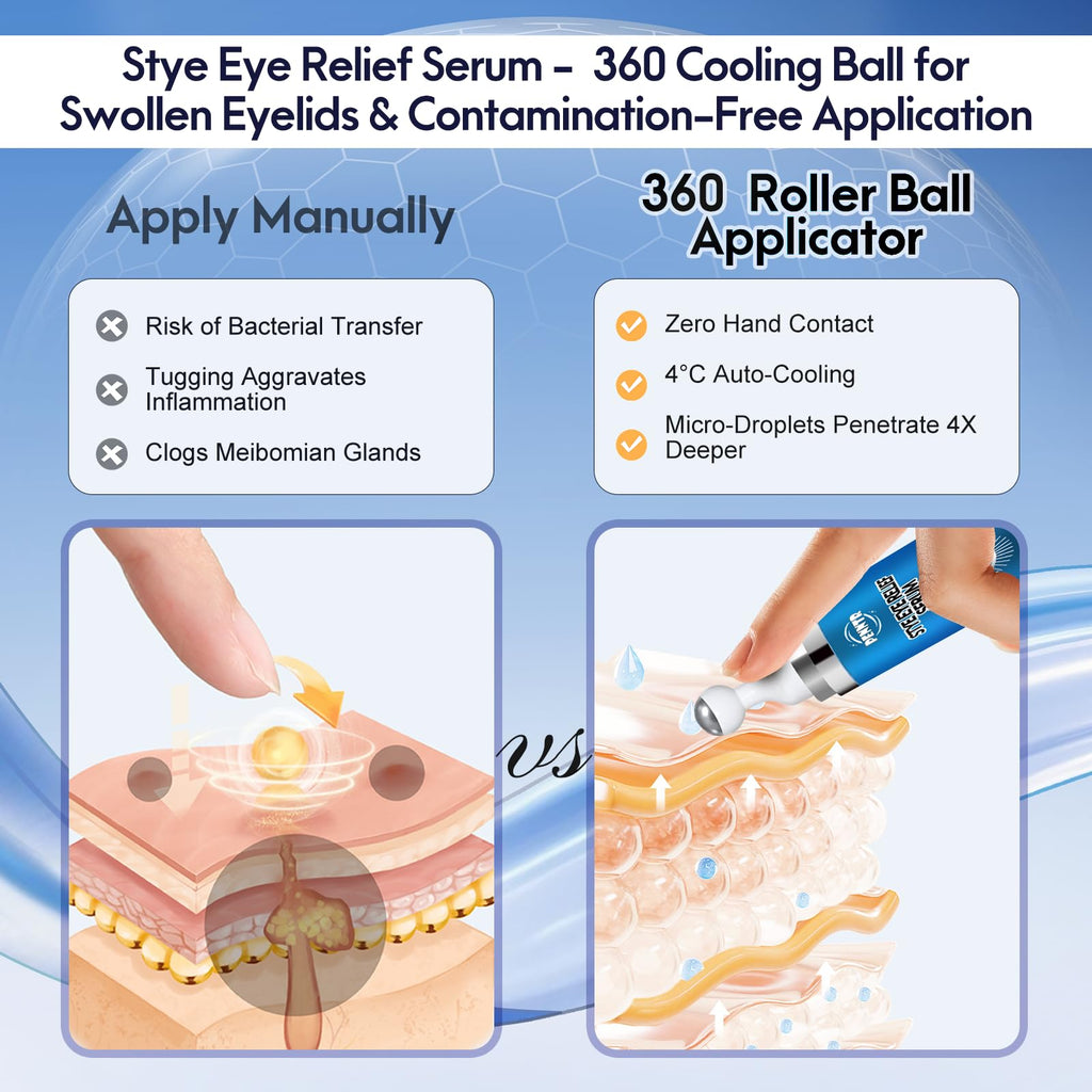 Penntr chalazion and blepharitis relief serum bottle