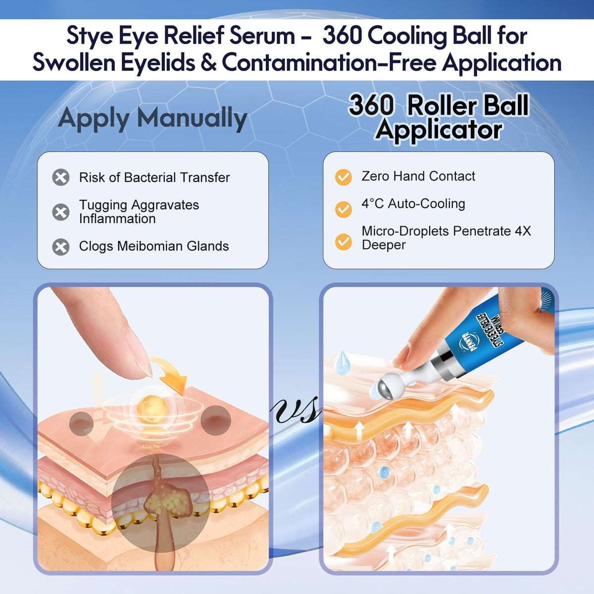 Penntr chalazion and blepharitis relief serum bottle