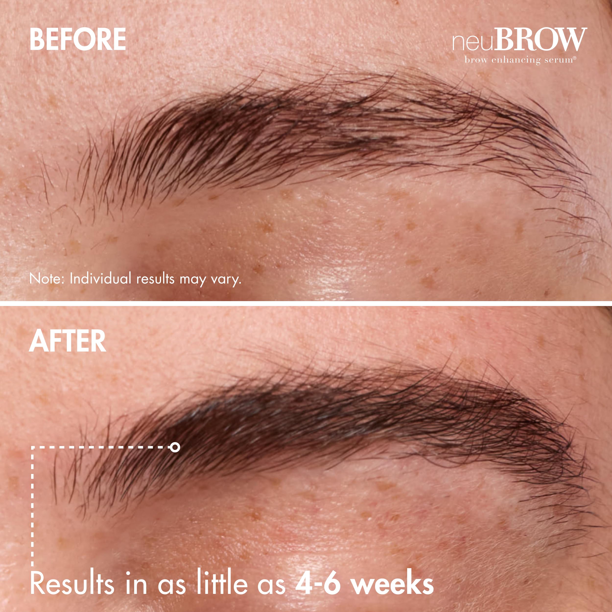 Clinical brow serum for fuller hair
