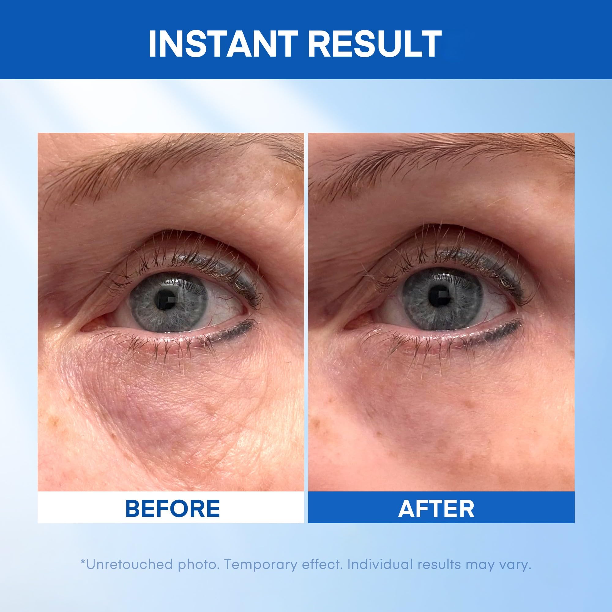Side profile of HealthyDerm 20ml tightening eye serum tube