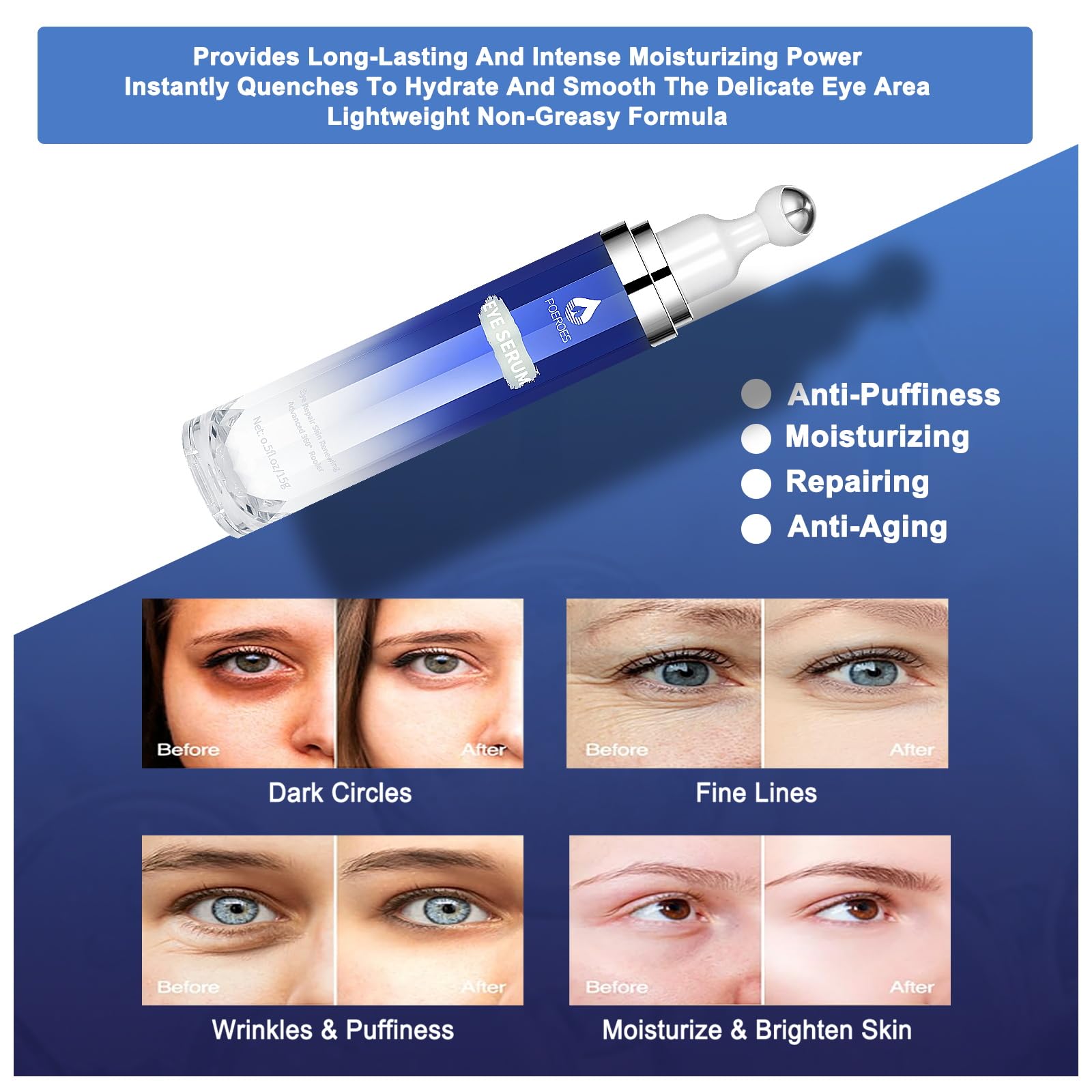 Poeroes eye serum 0.5 fluid ounce container size reference