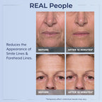 Model demonstrating application of Plexaderm under eye serum