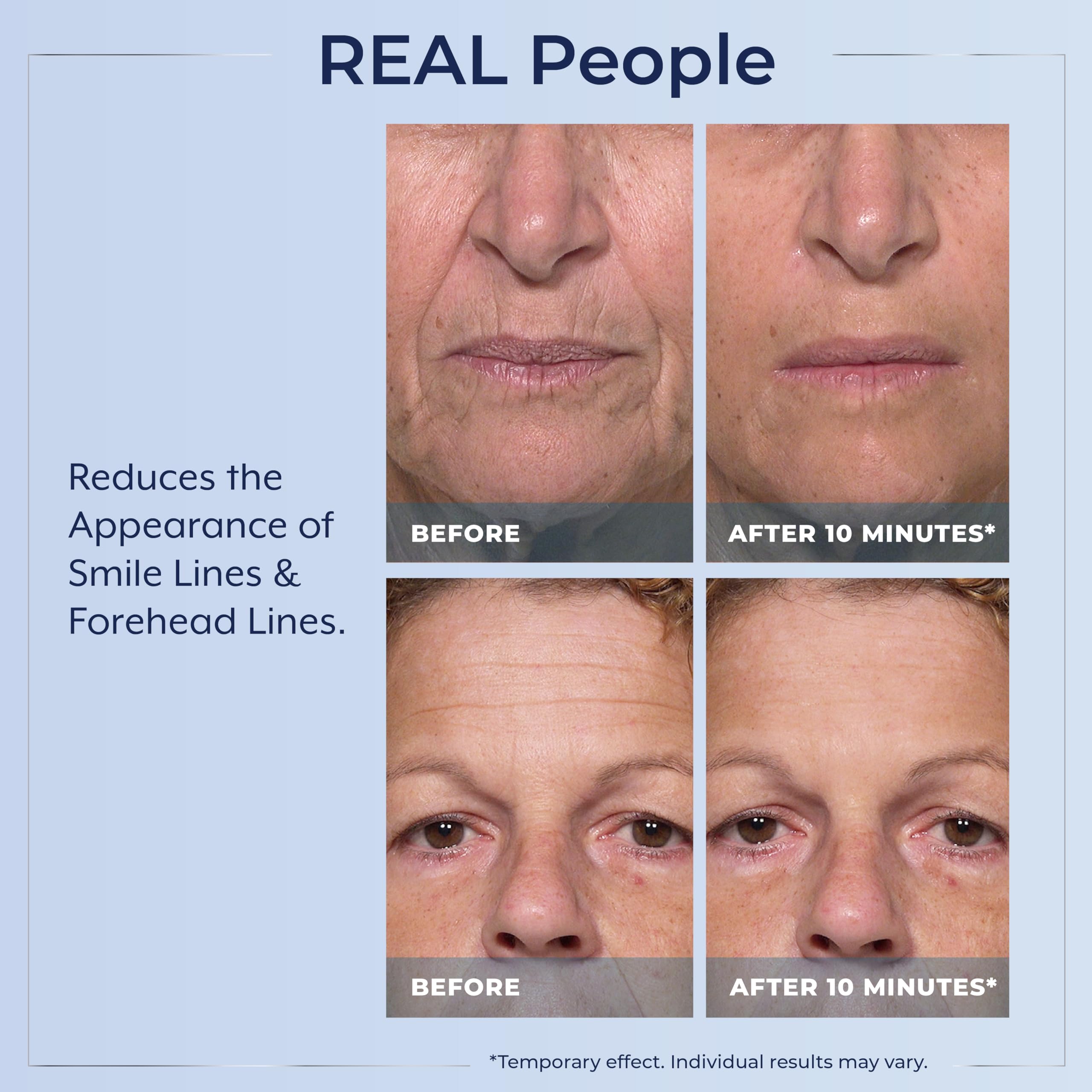 Authentic USA imported Plexaderm serum for fine lines and crow feet