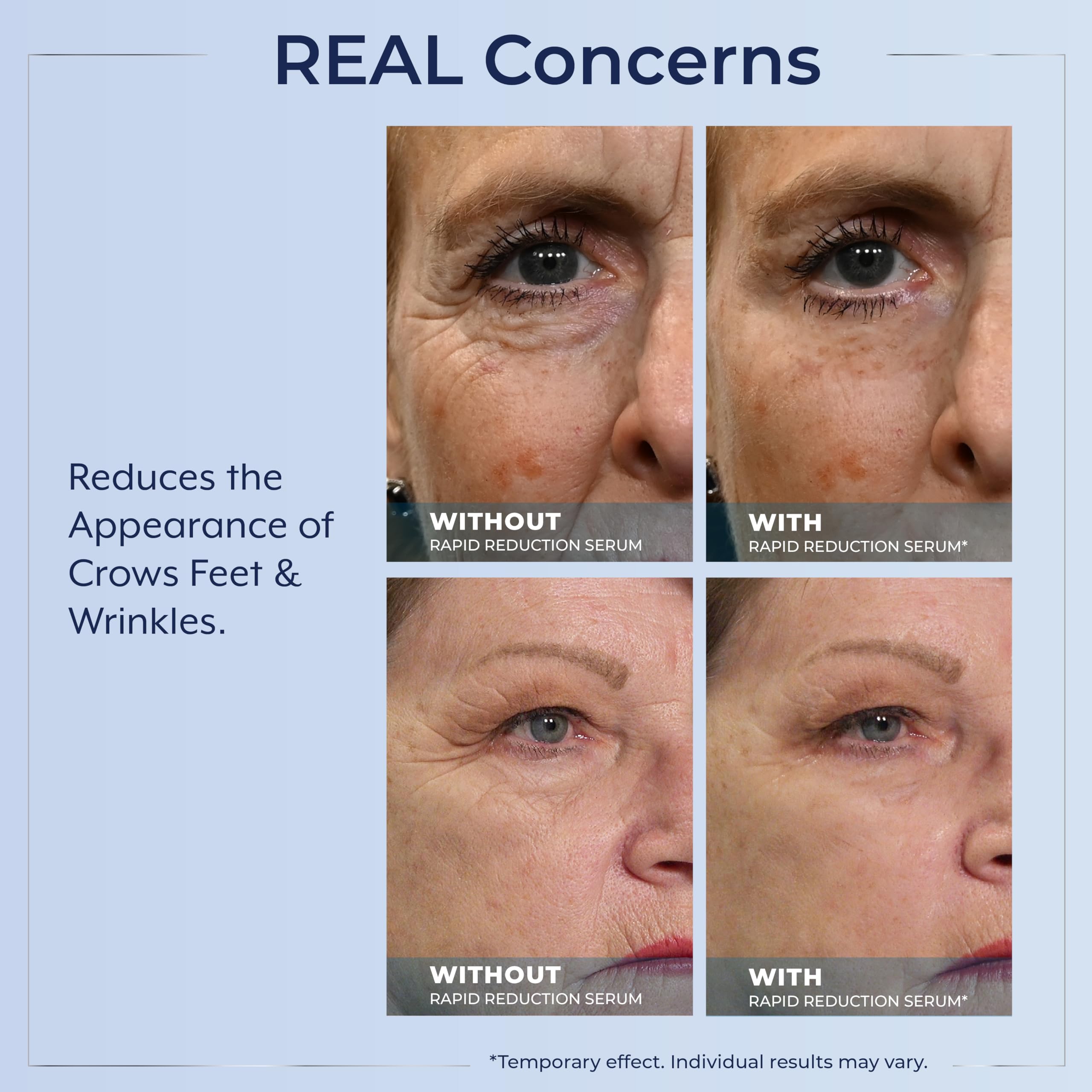 Plexaderm Rapid Reduction Serum display box and product