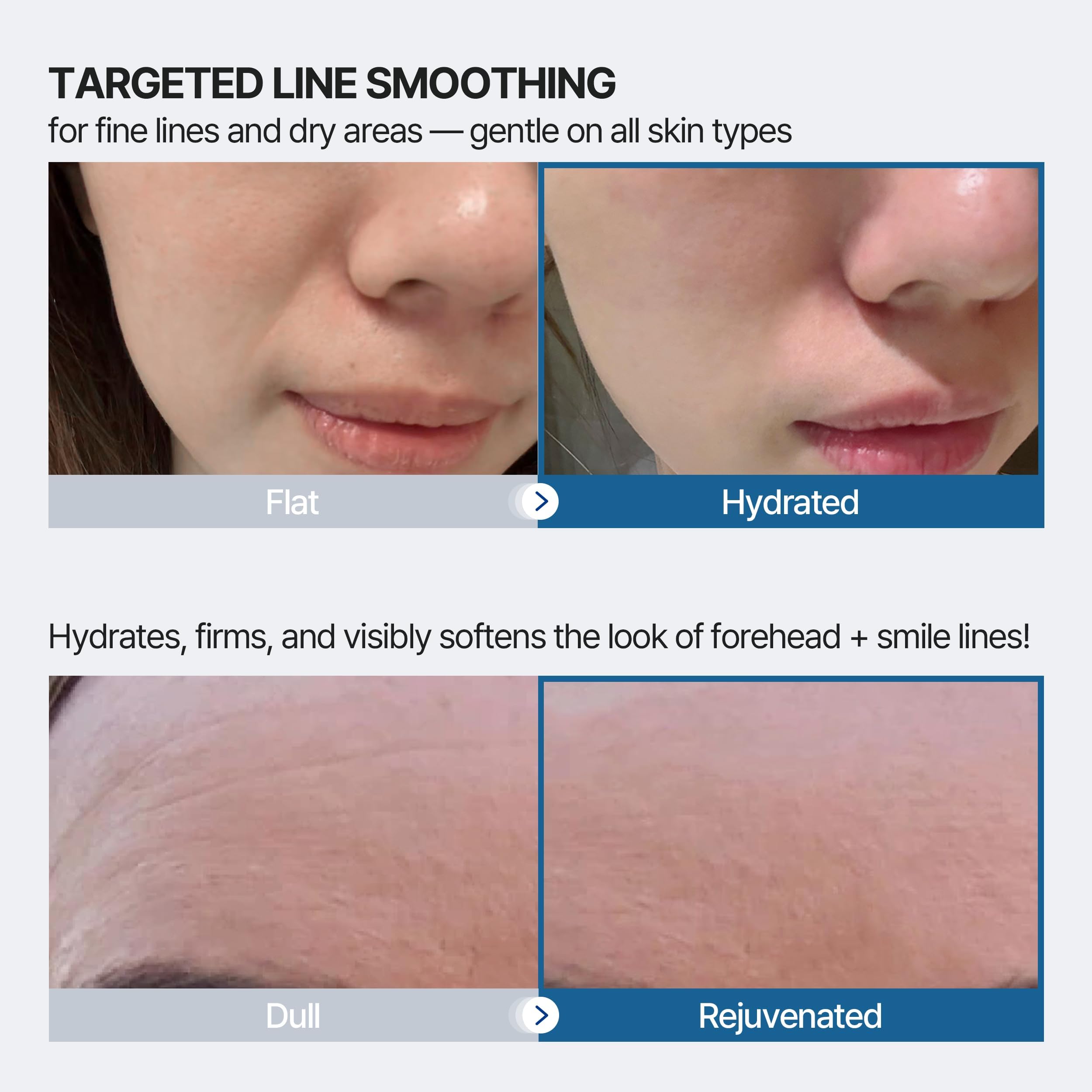 Authentic USA imported Honeydew Labs wrinkle patches showing the contoured shapes for nasolabial folds and frown lines.
