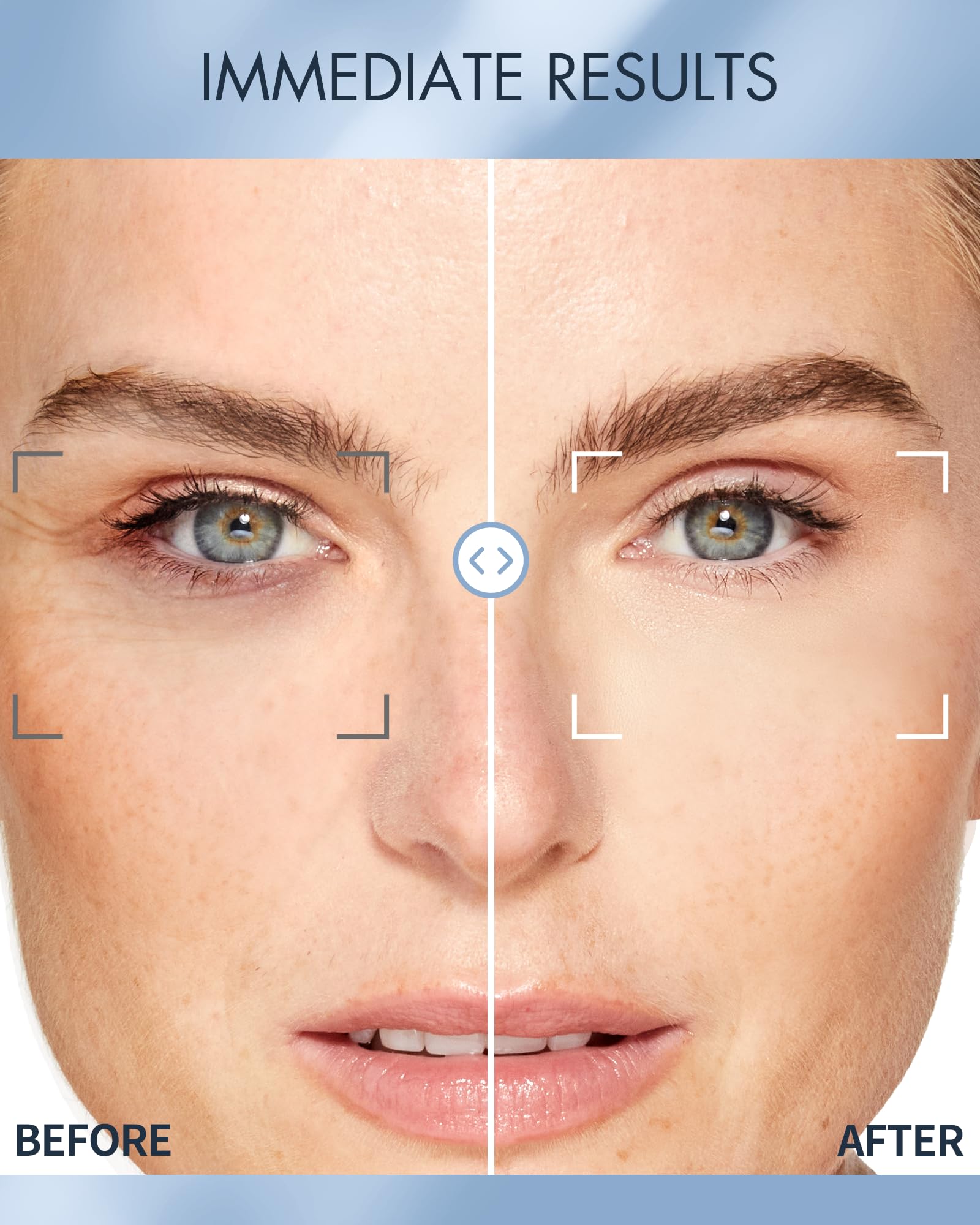 Close-up of Depology hydrogel patches designed to target under-eye puffiness and fine lines.