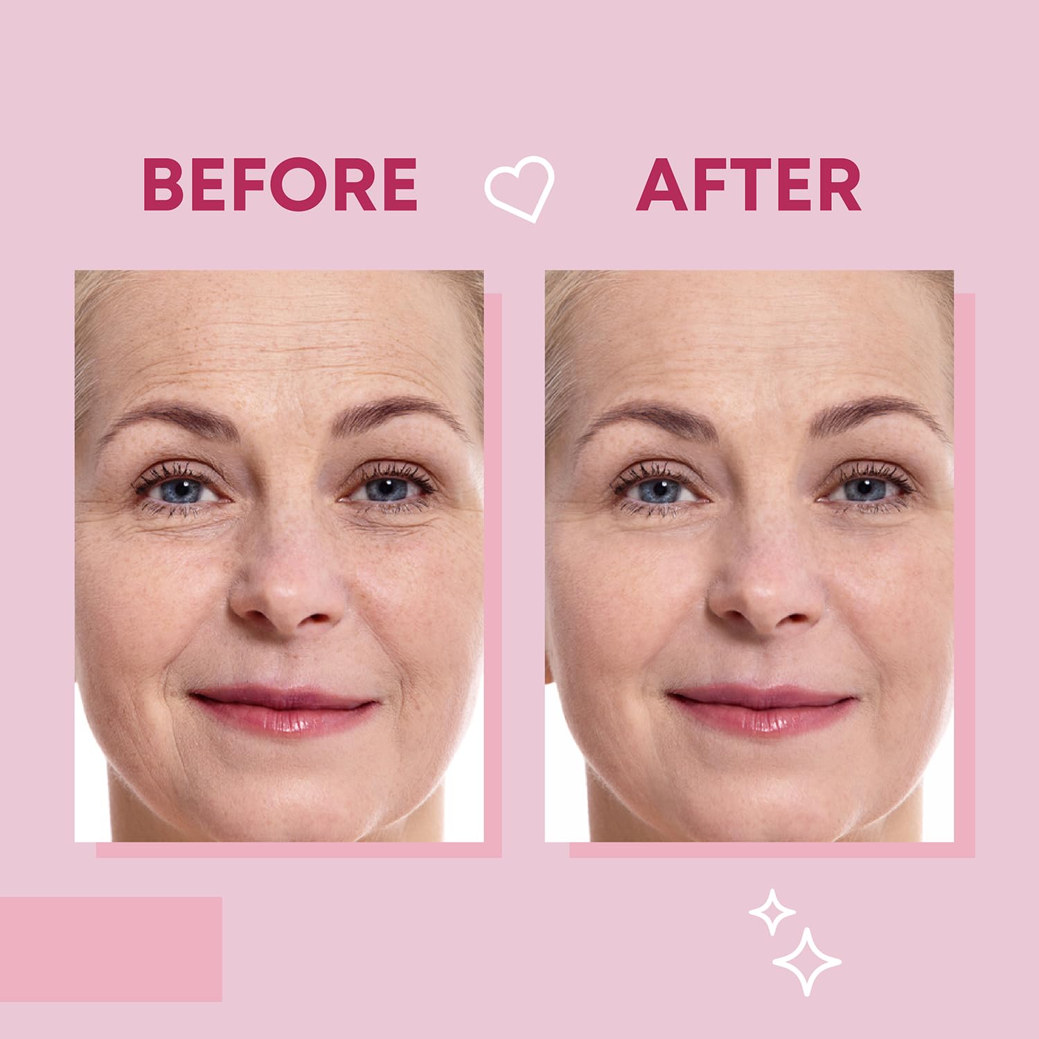 Bayside overnight facial patches infused with hyaluronic acid and collagen ingredients