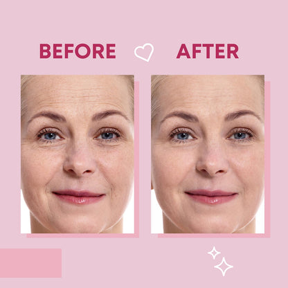 Bayside overnight facial patches infused with hyaluronic acid and collagen ingredients