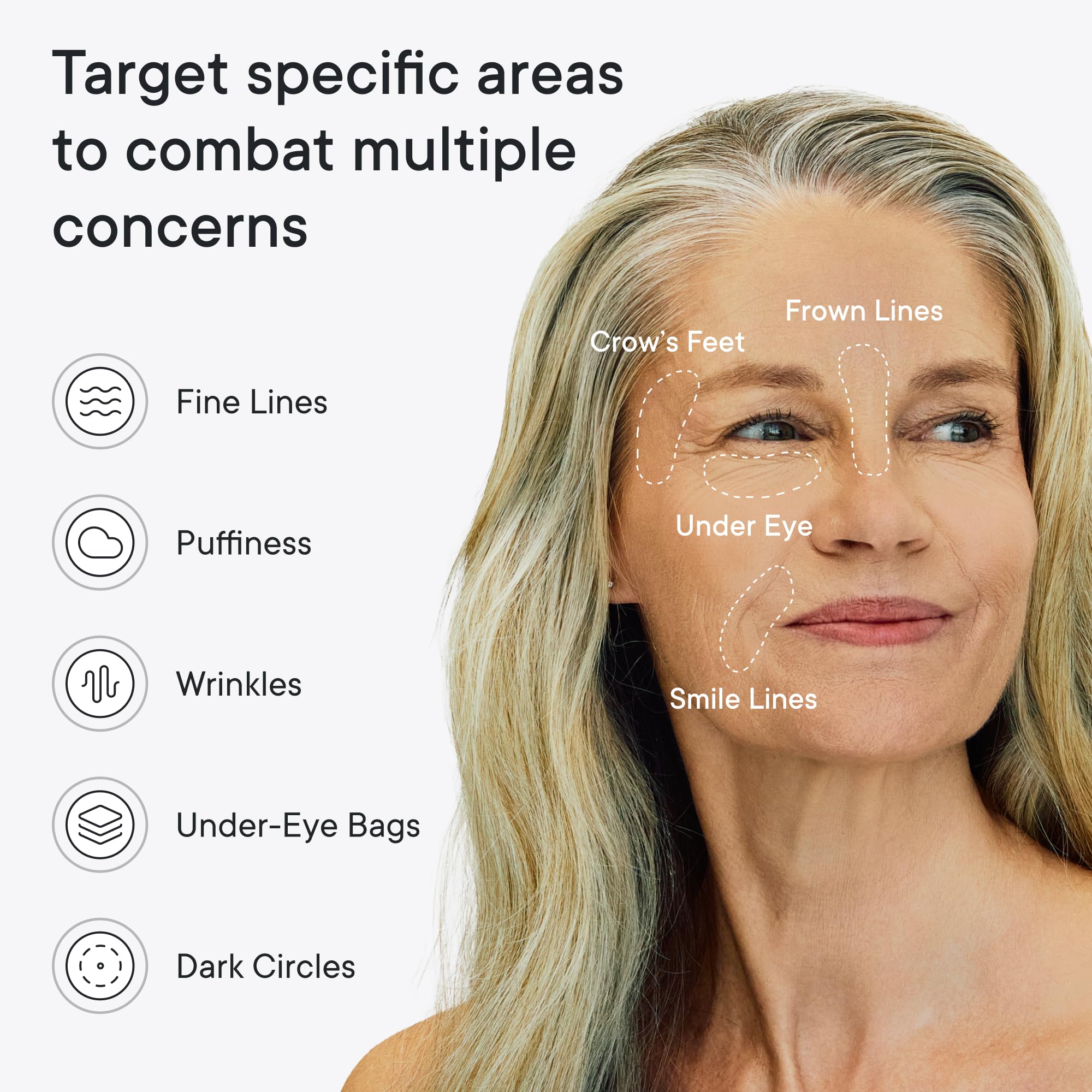 Qure dissolving micro needle under eye patches for dark circles