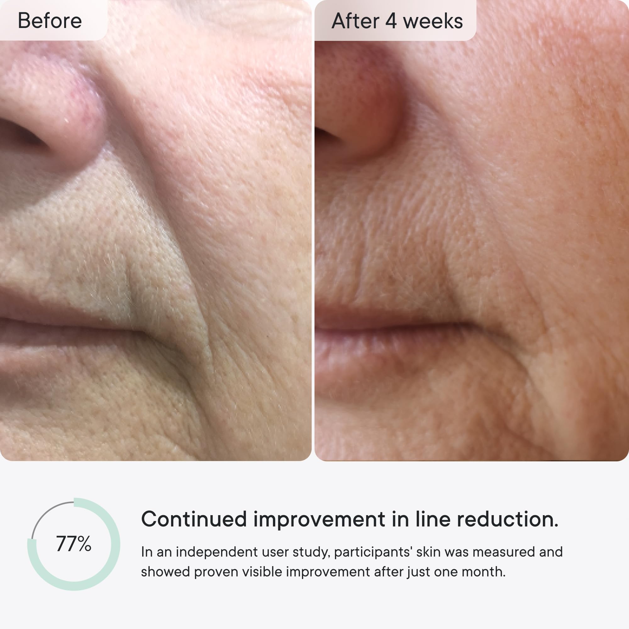 Qure micro infusion targeted patches packaging with active ingredient text