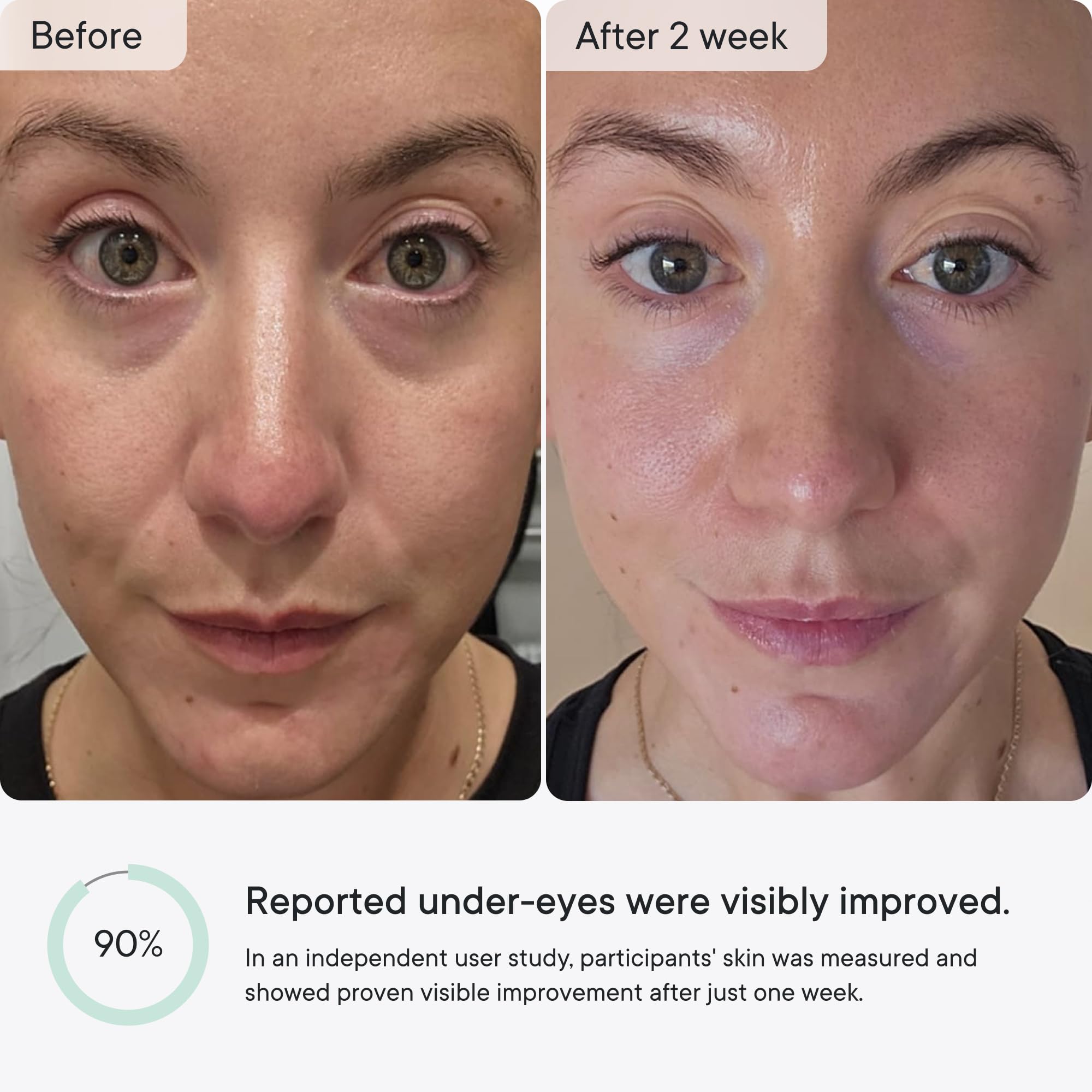 Qure anti wrinkle patches overnight skincare treatment application
