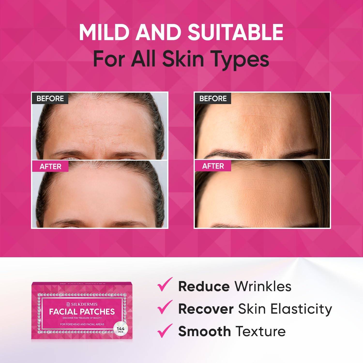 Silkdermis red variant wrinkle patches for comprehensive facial skincare routine.