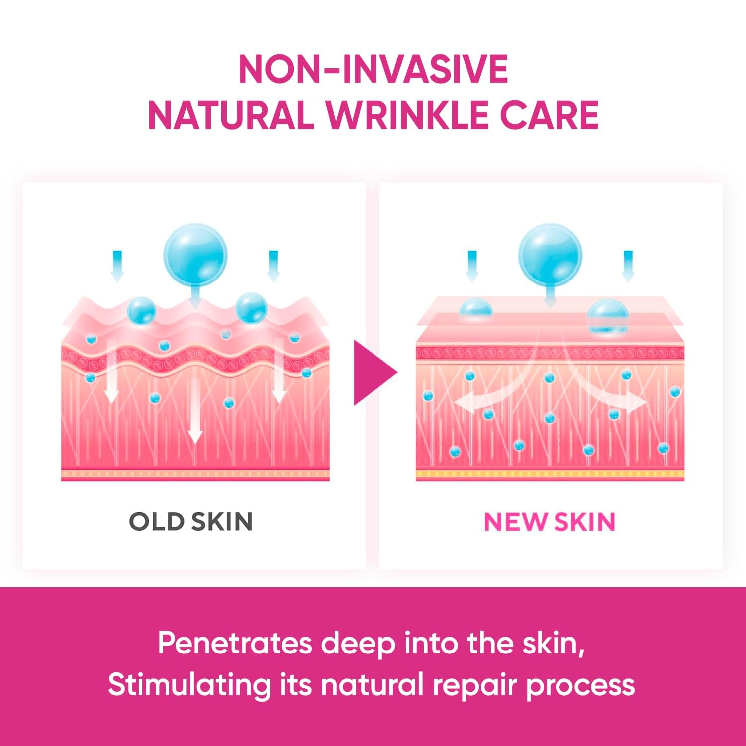 Authentic USA imported Silkdermis wrinkle patch kit contents and instructions.