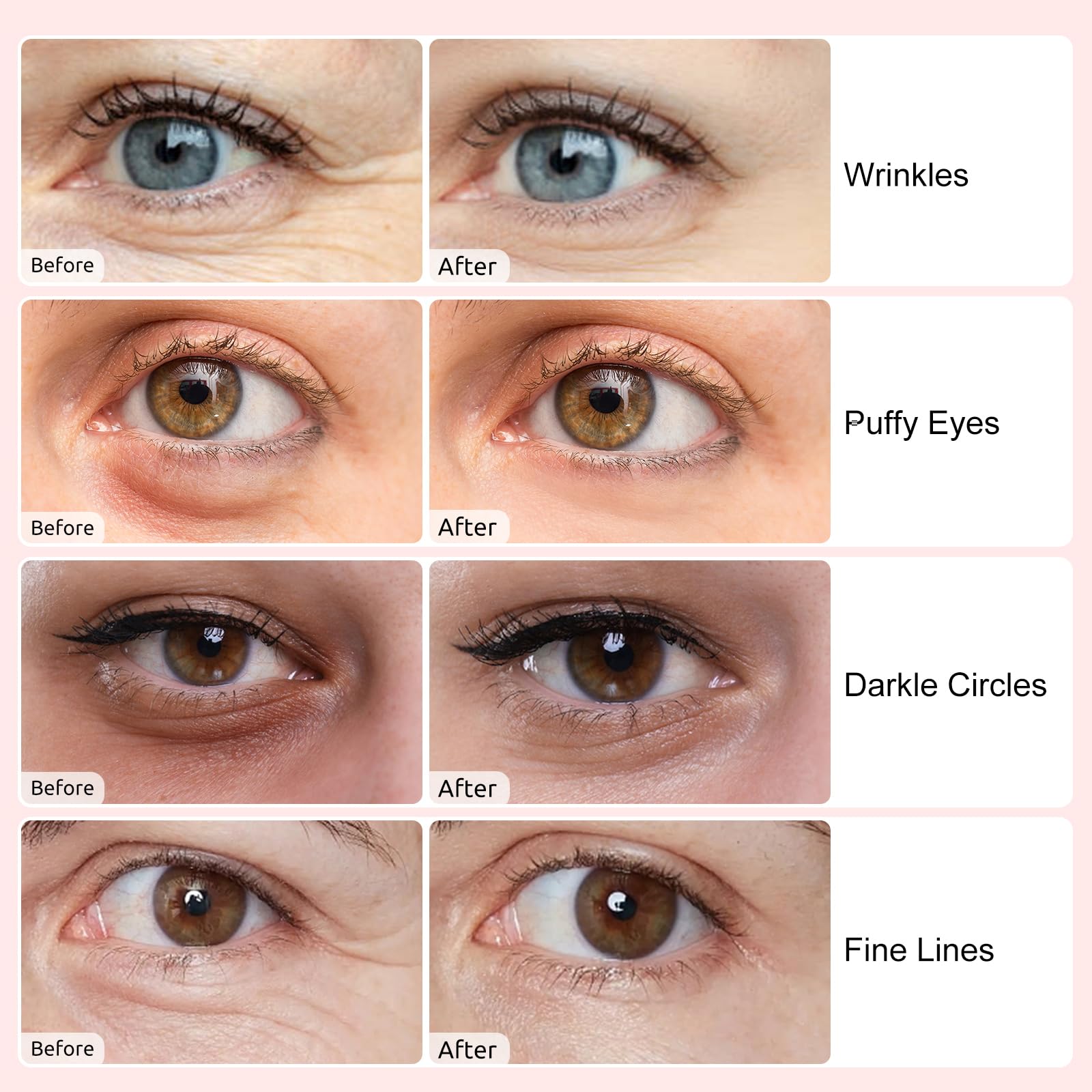 Model applying the blue collagen eye patch under the eye area to demonstrate proper skincare application.