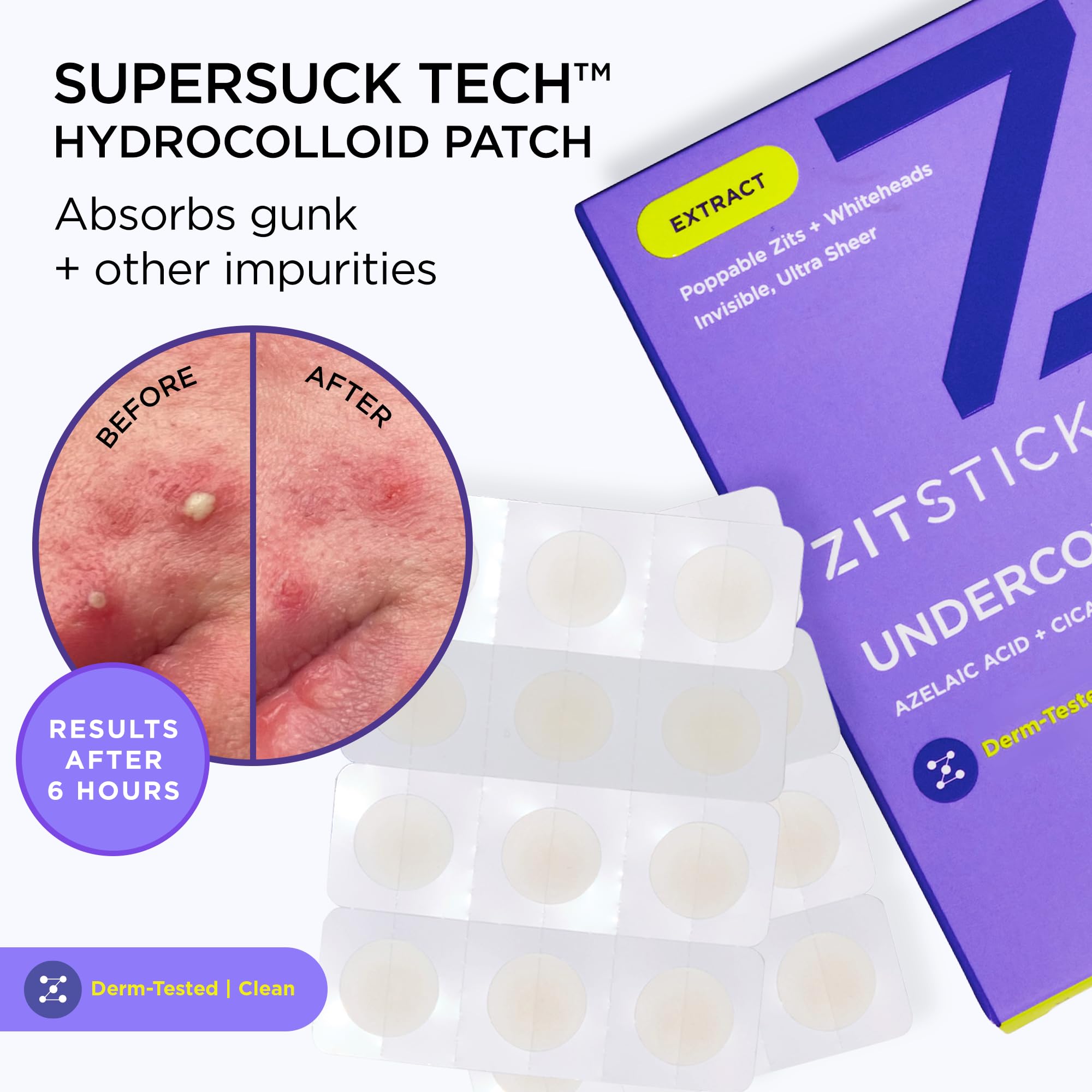 Close up view comparing the twenty four 12mm and twelve 10mm daytime invisible pimple patches.