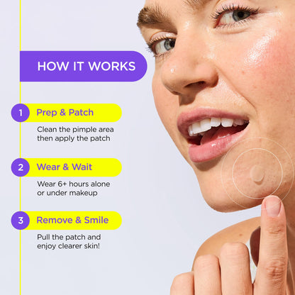 Authentic USA imported ZitSticka acne treatment box detailing active ingredients including tea tree.