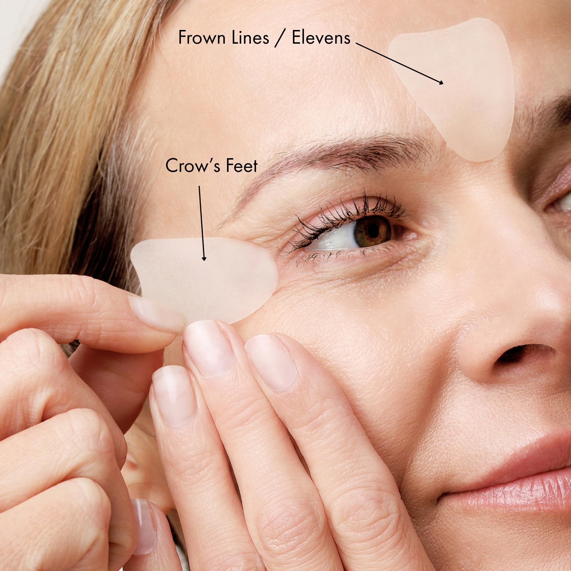 Close-up of KPLUS overnight patches being applied to the forehead for fine line smoothing.