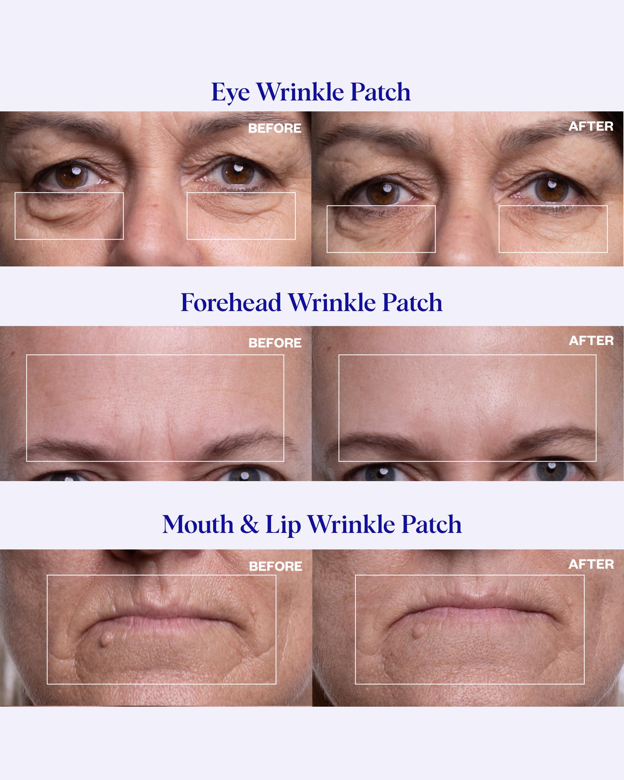 Reusable forehead patches from the facial smoothing set applied for frown line reduction