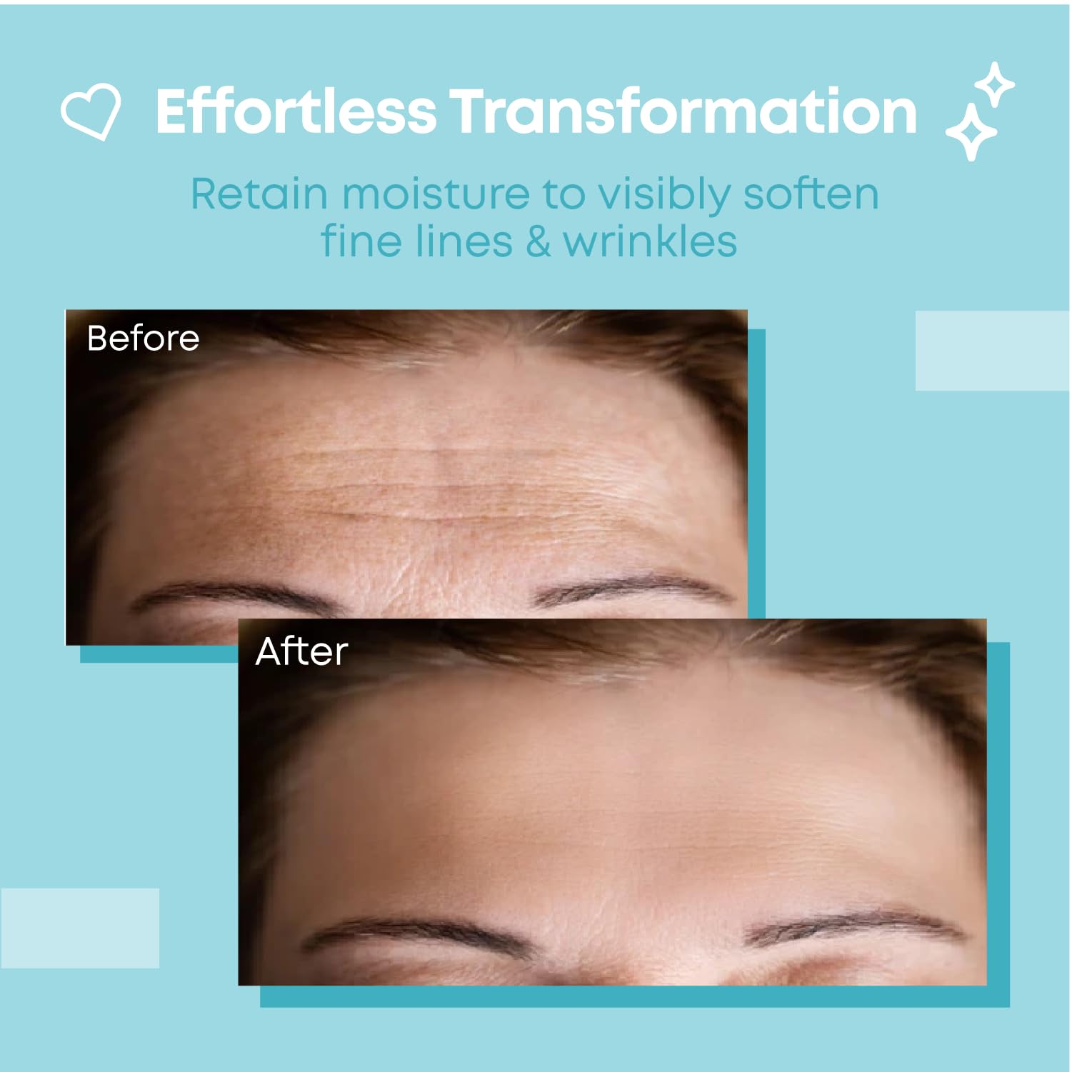 Bayside non invasive forehead wrinkle patch placed inside its protective metal storage tin