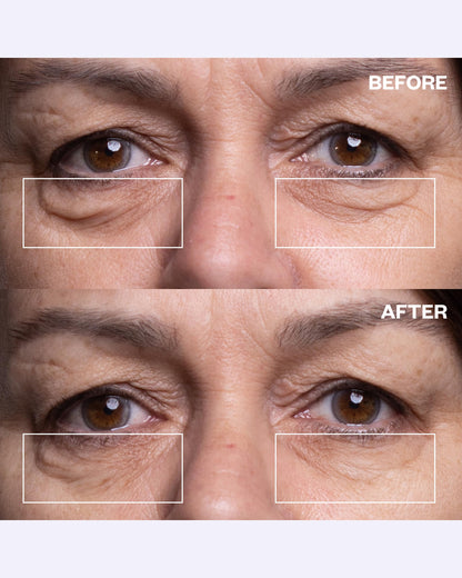 Close up of Wrinkles Schminkles eye patch application