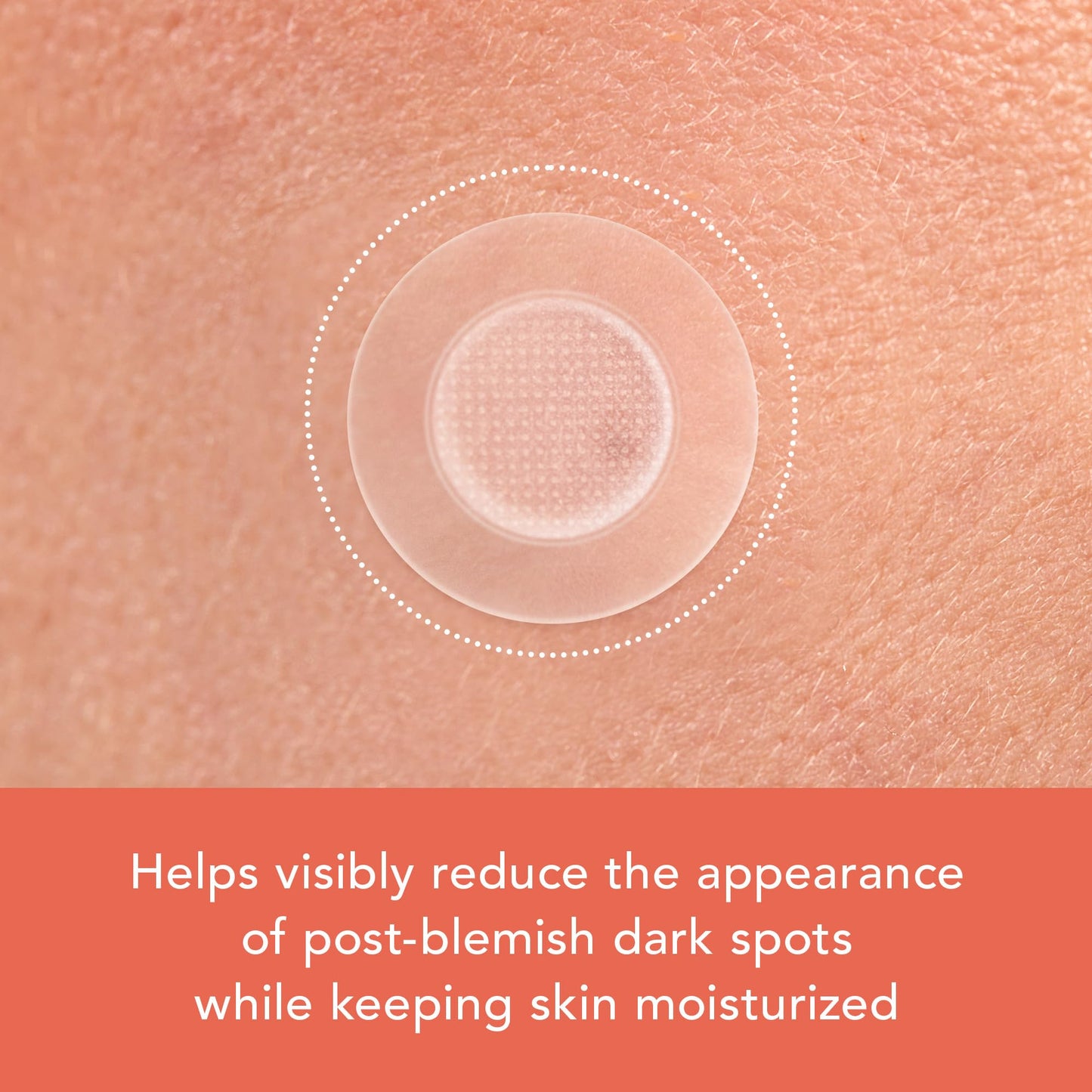 Model applying the transparent Korean skin care dark spot pimple patch to clean dry skin.
