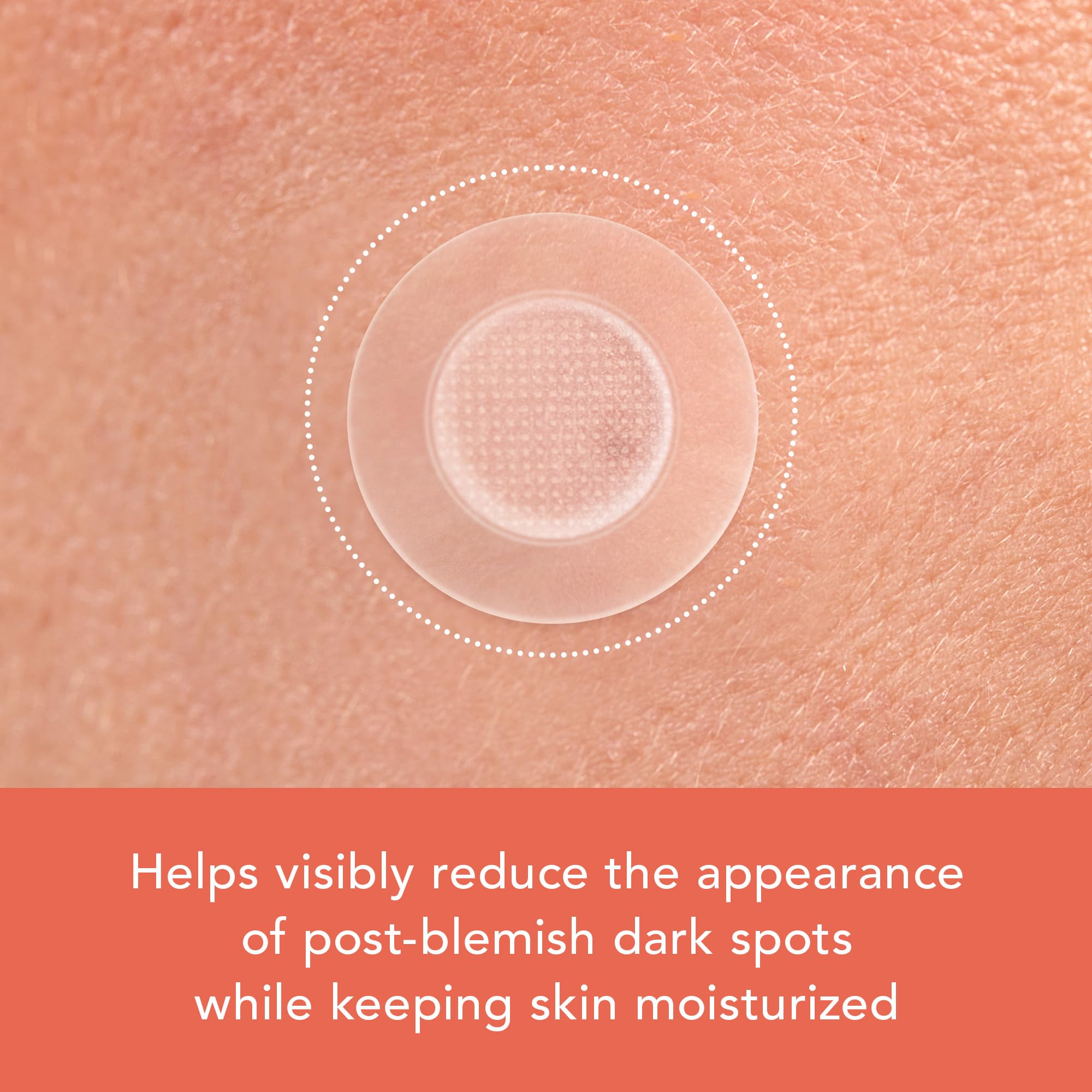 Model applying the transparent Korean skin care dark spot pimple patch to clean dry skin.