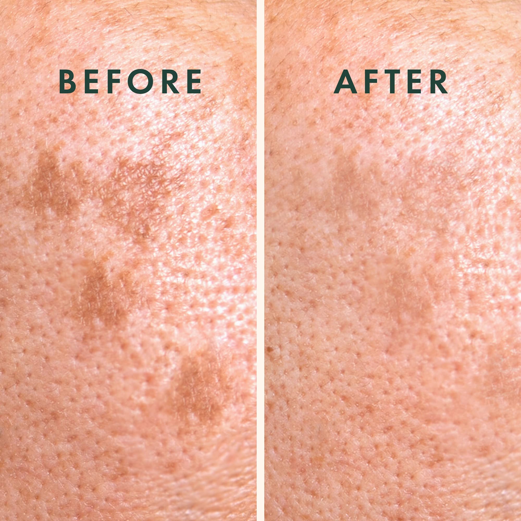 The nine count sheet of Rael Vitamin C and Glutathione infused hydrocolloid acne covers.