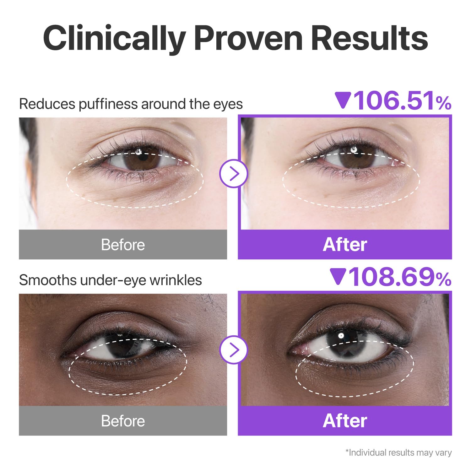 Numbuzin anti aging under eye treatment box with ingredients list displayed