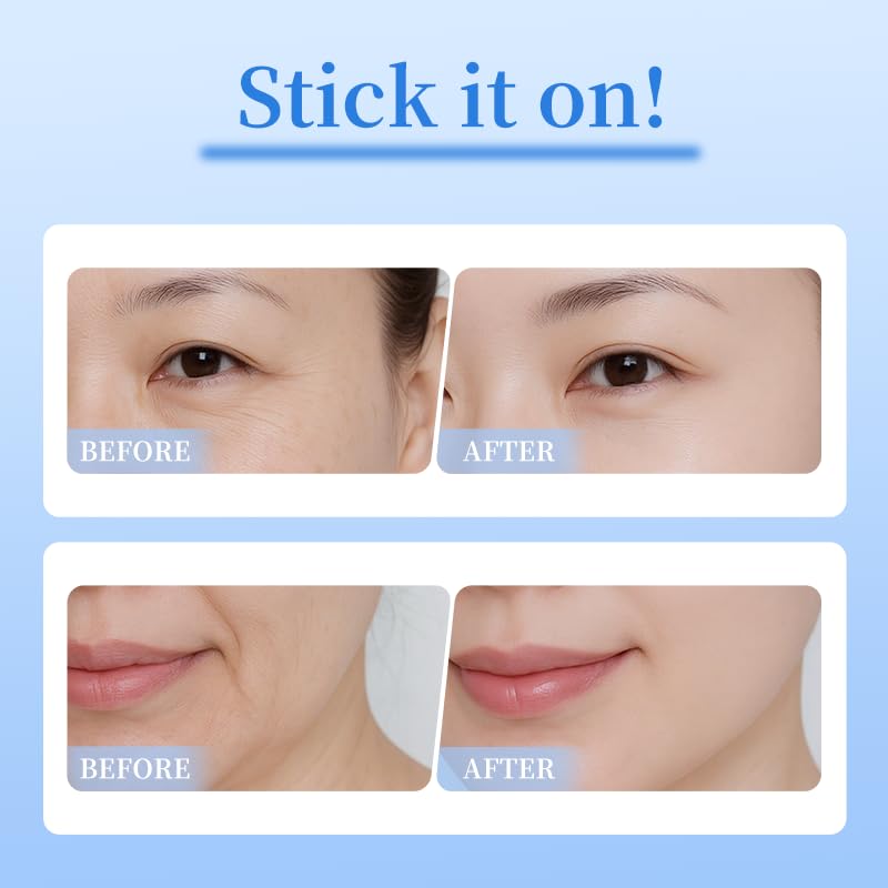 Skincare routine setup featuring authentic USA imported Natener PDRN micro eye patches.
