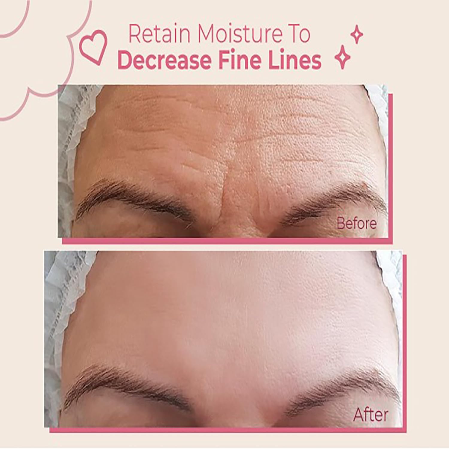 Bayside silicone forehead wrinkle patches being applied to clean skin for overnight fine line smoothing.