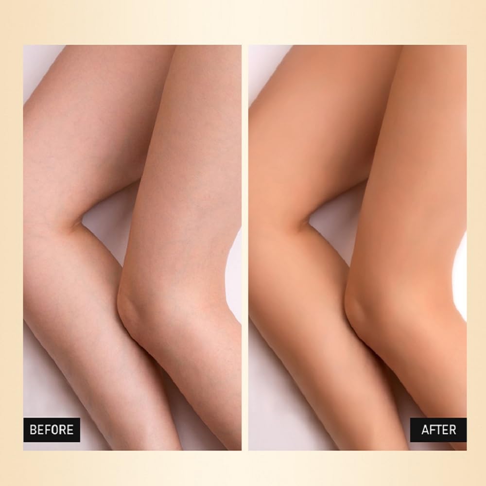 Leg concealer covering scars and veins comparison