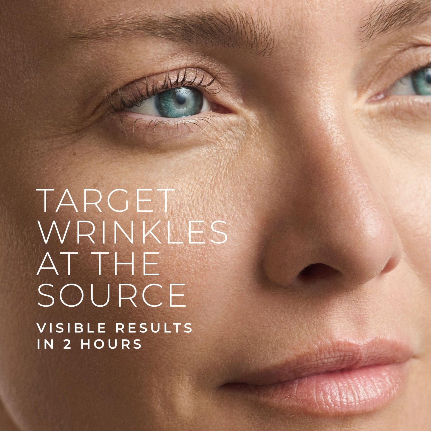 RoC Retinol Correxion targeted wrinkle patches applied to forehead lines and crows feet for expression line smoothing.