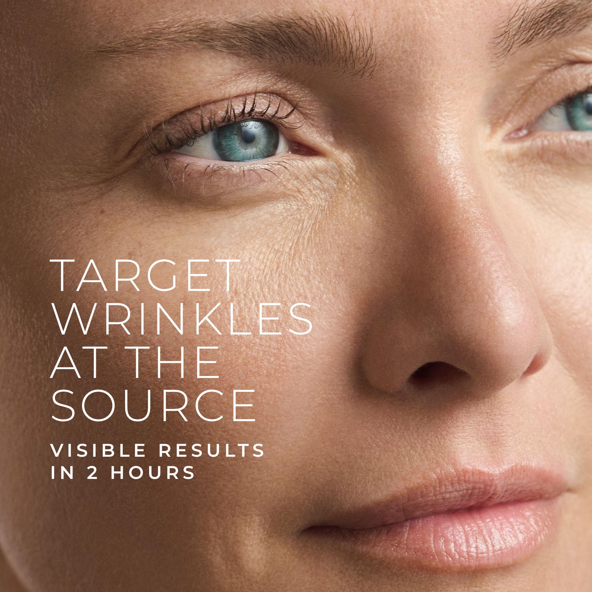 RoC Retinol Correxion targeted wrinkle patches applied to forehead lines and crows feet for expression line smoothing.