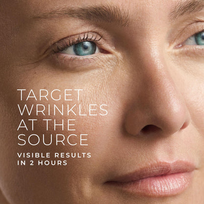RoC Retinol Correxion targeted wrinkle patches applied to forehead lines and crows feet for expression line smoothing.