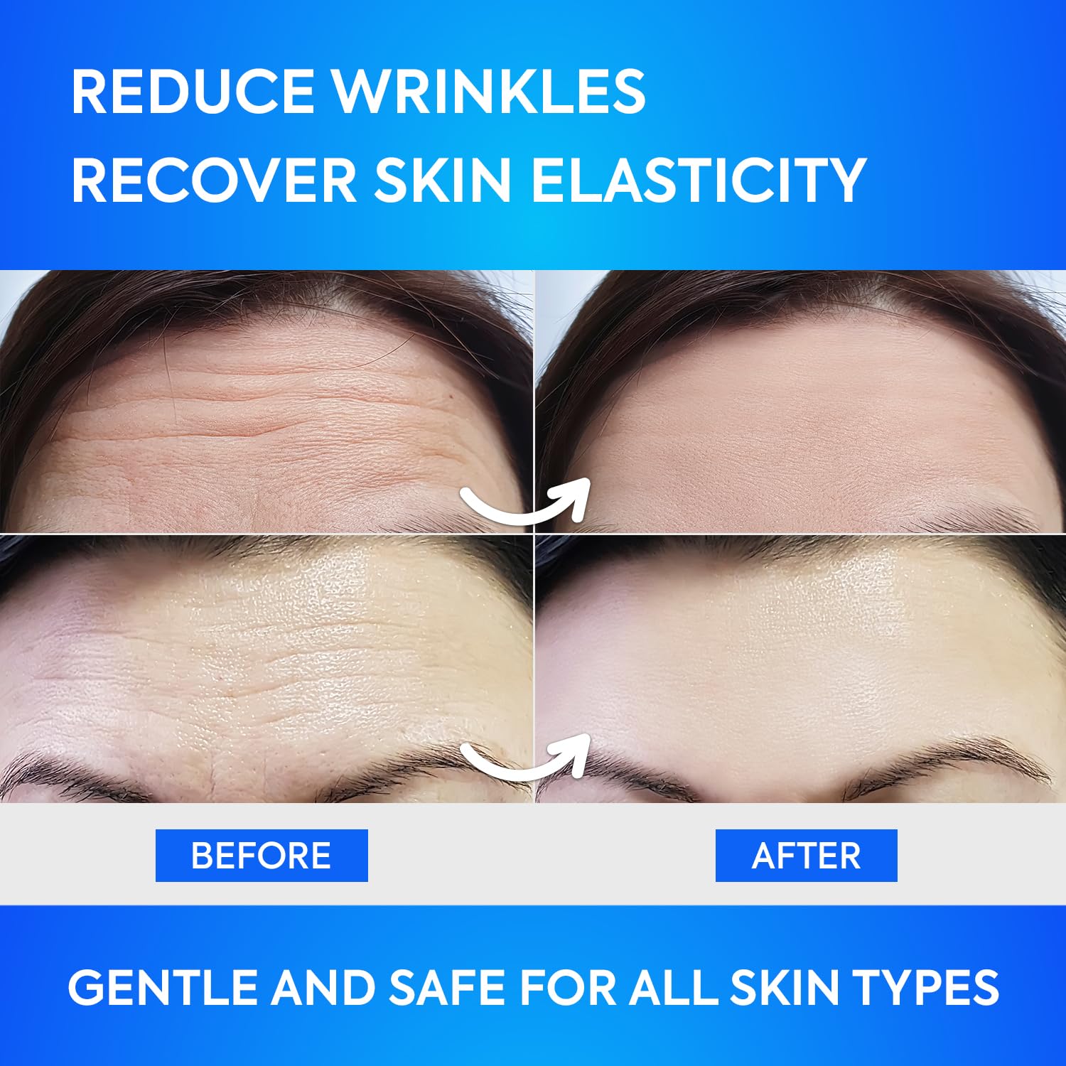Silkdermis facial wrinkle treatment patches showing the contoured shape designed specifically for forehead lines.