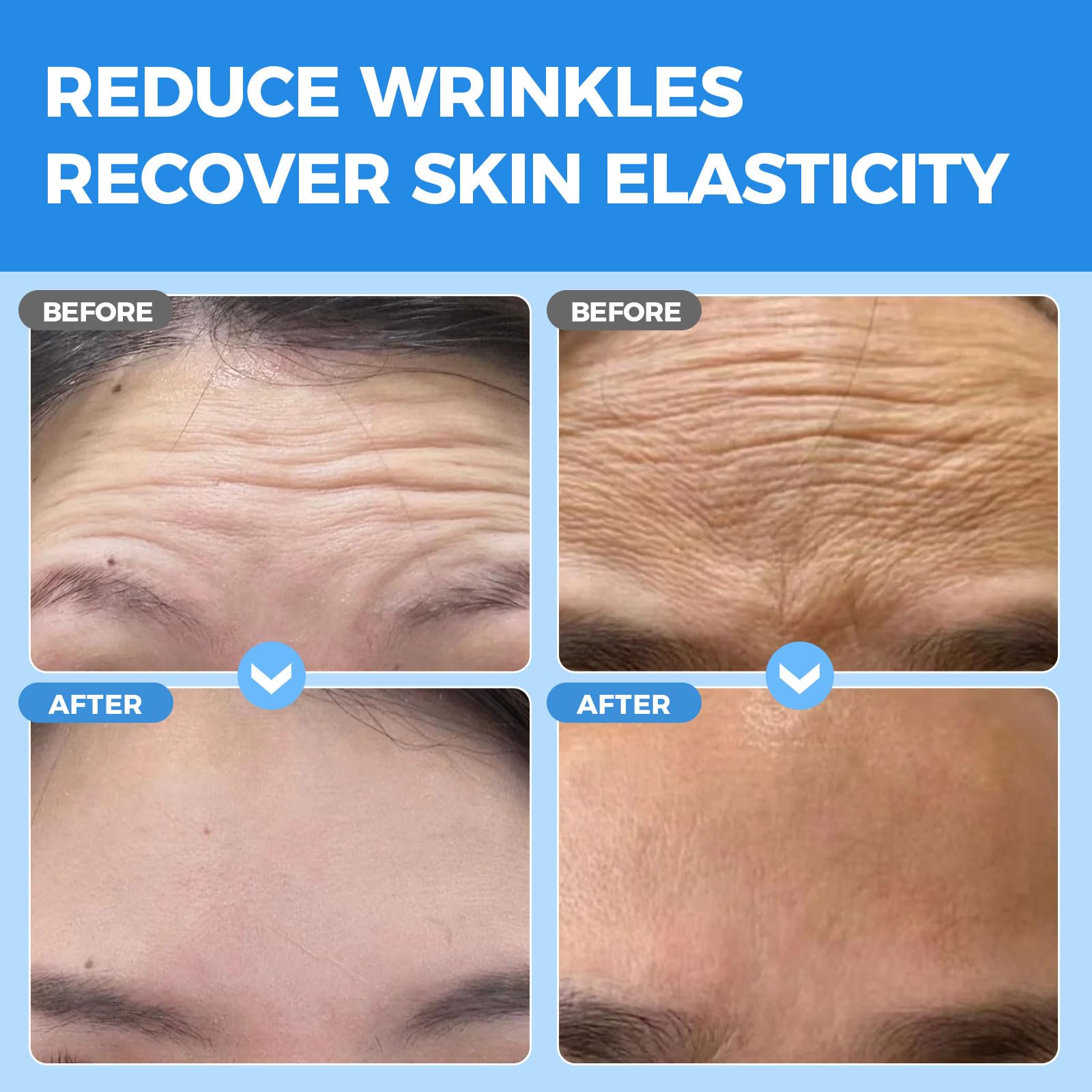 Okela collagen hydrogel patches being applied to the forehead for overnight wrinkle reduction.